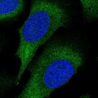 Immunofluorescent staining of human cell line U-2 OS shows localization to cytosol.