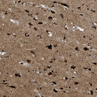 Immunohistochemical staining of human cerebral cortex shows strong cytoplasmic positivity in neuronal cells.