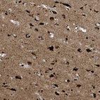 Immunohistochemical staining of human cerebral cortex shows strong cytoplasmic positivity in neuronal cells.