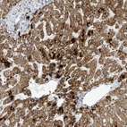 Immunohistochemical staining of human liver shows strong cytoplasmic granular positivity in hepatocytes.