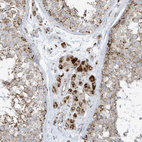 Immunohistochemical staining of human testis shows strong cytoplasmic granular positivity in Leydig cells.