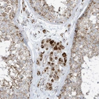Immunohistochemical staining of human testis shows strong cytoplasmic granular positivity in Leydig cells.