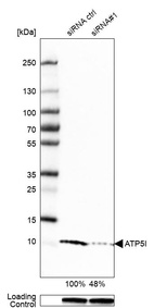 Western blot analysis in U-251MG cells transfected with control siRNA, target specific siRNA probe #1, using Anti-ATP5I antibody. Remaining relative intensity is presented. Loading control: Anti-GAPDH.