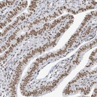 Immunohistochemical staining of human Fallopian tube shows strong nuclear positivity in glandular cells.