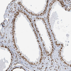 Immunohistochemical staining of human prostate shows strong nuclear positivity in glandular cells.
