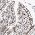 Immunohistochemical staining of human small intestine shows strong nuclear positivity in glandular cells.