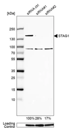 Western blot analysis in U-138MG cells transfected with control siRNA, target specific siRNA probe #1 and #2, using Anti-STAG1 antibody. Remaining relative intensity is presented. Loading control: Anti-GAPDH.