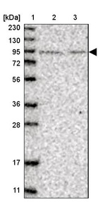 Lane 1: Marker [kDa] 230, 130, 95, 72, 56, 36, 28, 17, 11_br/_Lane 2: Human cell line RT-4_br/_Lane 3: Human cell line U-251MG sp