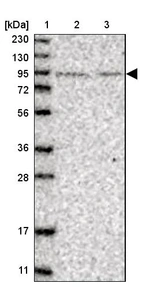 Lane 1: Marker [kDa] 230, 130, 95, 72, 56, 36, 28, 17, 11_br/_Lane 2: Human cell line RT-4_br/_Lane 3: Human cell line U-251MG sp