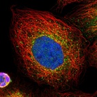 Immunofluorescent staining of human cell line A-431 shows localization to cytosol & vesicles.