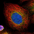 Immunofluorescent staining of human cell line A-431 shows localization to cytosol & vesicles.