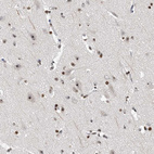 Immunohistochemical staining of human cerebral cortex shows strong positivity in nucleoli in neurons.
