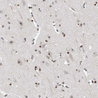 Immunohistochemical staining of human cerebral cortex shows strong positivity in nucleoli in neurons.
