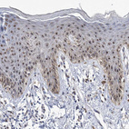 Immunohistochemical staining of human skin shows strong positivity in nucleoli in squamous epithelial cells.