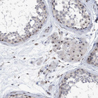 Immunohistochemical staining of human testis shows strong positivity in nucleoli in Leydig cells.