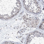 Immunohistochemical staining of human testis shows strong positivity in nucleoli in Leydig cells.