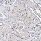 Immunohistochemical staining of human kidney shows moderate positivity in nucleoli in cells in tubules.