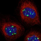 Immunofluorescent staining of human cell line A-431 shows localization to nucleoli.