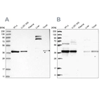 Western blot analysis using Anti-TBCC antibody HPA035073 (A) shows similar pattern to independent antibody HPA035074 (B).