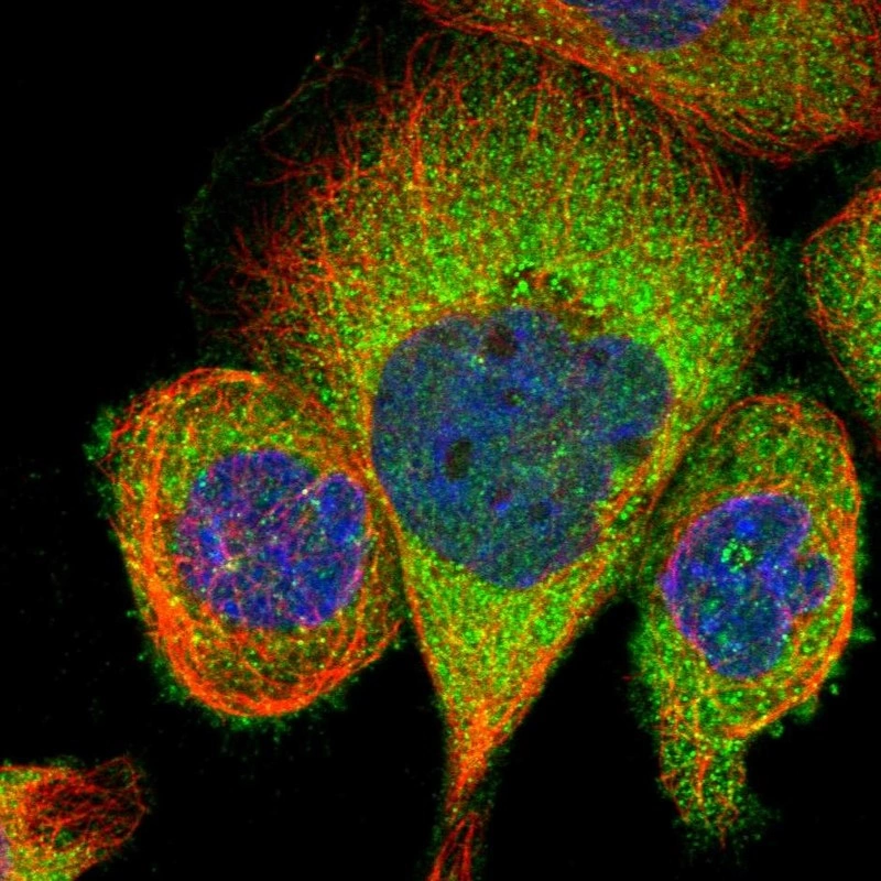 Rabbit Polyclonal Anti-TBCC Antibody - Buy for research - Highly ...