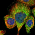 Immunofluorescent staining of human cell line A-431 shows localization to cytosol.