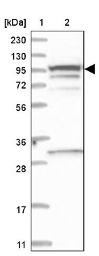 Lane 1: Marker [kDa] 230, 130, 95, 72, 56, 36, 28, 17, 11_br/_Lane 2: Human cell line RT-4