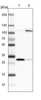 Lane 1: NIH-3T3 cell lysate (Mouse embryonic fibroblast cells)_br/_Lane 2: NBT-II cell lysate (Rat Wistar bladder tumour cells)