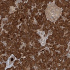 Anti-KIAA0556 Antibody