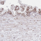 Anti-MBNL1 Antibody