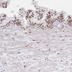 Anti-MBNL1 Antibody