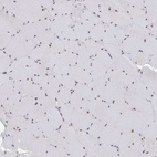 Immunohistochemical staining of human skeletal muscle shows moderate nuclear positivity in myocytes.