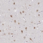 Immunohistochemical staining of human cerebral cortex shows moderate cytoplasmic positivity in neurons.