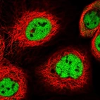 Immunofluorescent staining of human cell line A-431 shows localization to nucleoplasm & cytosol.