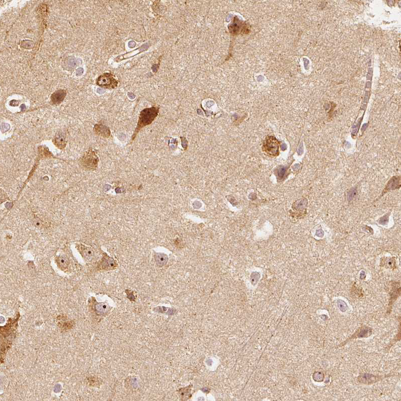 Anti-ARHGAP26 Antibody