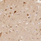 Anti-ARHGAP26 Antibody