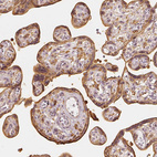 Immunohistochemical staining of human placenta shows moderate cytoplasmic and membranous positivity in trophoblastic cells.