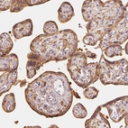 Immunohistochemical staining of human placenta shows moderate cytoplasmic and membranous positivity in trophoblastic cells.