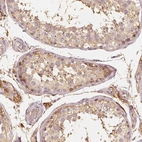 Immunohistochemical staining of human testis shows weak cytoplasmic positivity in cells in seminiferous ducts.