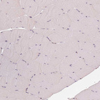 Immunohistochemical staining of human skeletal muscle shows no positivity in myocytes as expected.