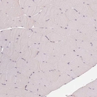 Immunohistochemical staining of human skeletal muscle shows no positivity in myocytes as expected.