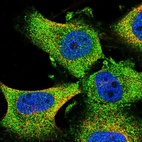 Immunofluorescent staining of human cell line U-251 MG shows localization to cytosol.