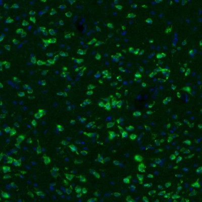 Anti-GKAP1 Antibody