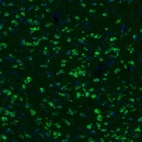 Anti-GKAP1 Antibody