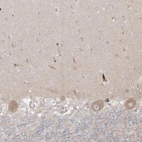 Immunohistochemical staining of human cerebellum shows positivity in Purkinje cells.