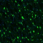Immunofluorescence staining of mouse forebrain shows neuronal positivity in globus pallidus.