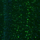Immunofluorescence staining of mouse retrosplenial cortex shows positivity in a subset of neurons.