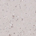 Immunohistochemical staining of human cerebral cortex shows weak positivity in neurons.