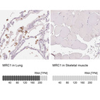 Anti-MRC1 Antibody