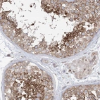 Immunohistochemical staining of human testis shows distinct cytoplasmic positivity in subsets of cells in seminiferus duct cells.