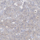 Anti-TRMT2B Antibody